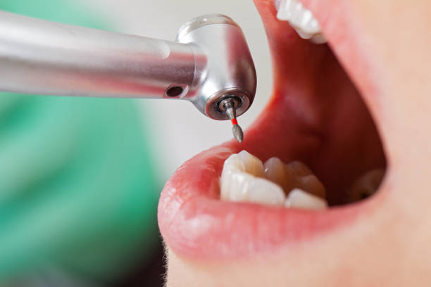 Best Broken Tooth Emergency  in Ocean City, FL